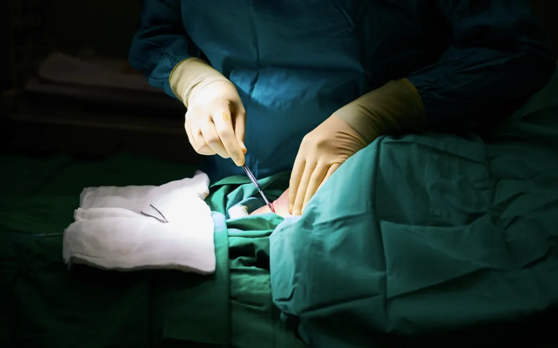 Des chirurgiens au bloc opératoire